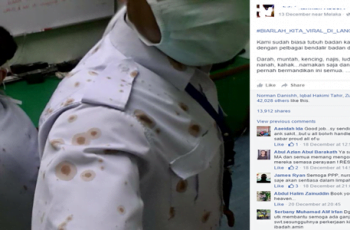kisah viral baju ma dipenuhi nanah dan darah pesakit.png