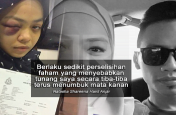 Gadis Alami Pendarahan Teruk Ditumbuk Tunang